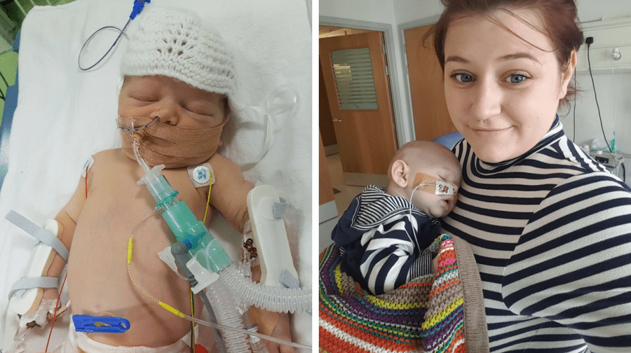 Kayleigh Moorcroft wants to warn other parents about the symptoms of sepsis after her baby Dexter almost died from the illness