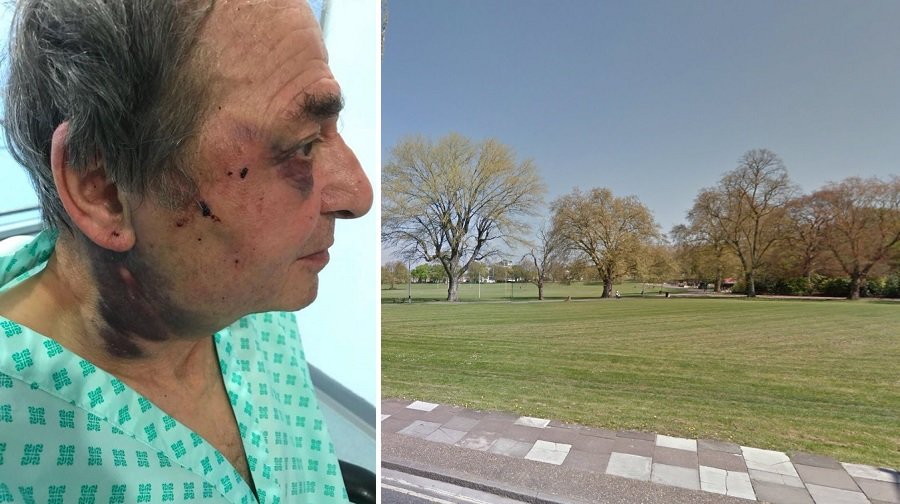OAP's terrible bruises after robbers knifed him in Peckham Rye Park